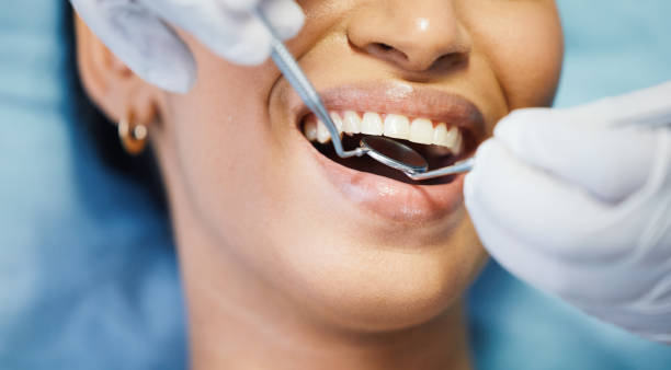 Best Emergency Wisdom Teeth Removal in Norton, OH